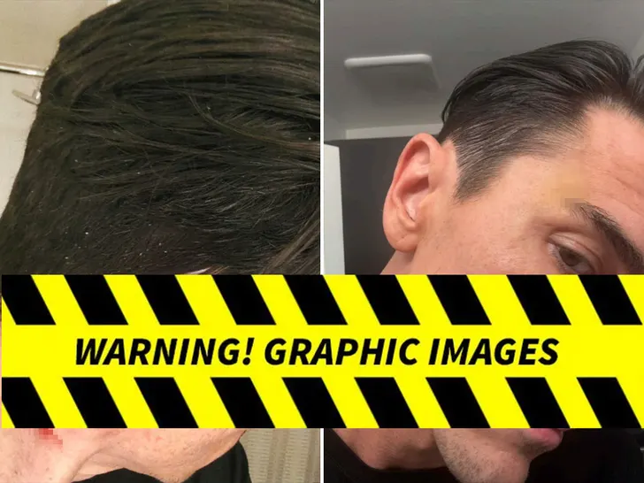 Tom Sandoval reportedly injured by Victoria Lee Robinson