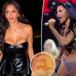 Nicole Scherzinger shows horrific injury after boiling water falls on her leg 1 hour before concert