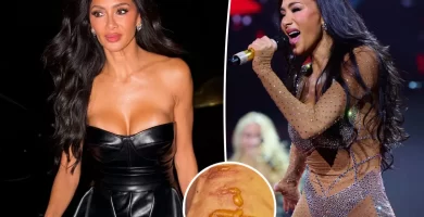 Nicole Scherzinger reveals horrific harm after boiling water falls on her leg 1 hour earlier than live performance 25 Nicole Scherzinger shows horrific injury after boiling water falls on her leg 1 hour before concert