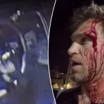 “Pretty Little Liars” star Keegan Allen was robbed at gunpoint and knife during an attack outside a luxury grocery store in Hollywood.