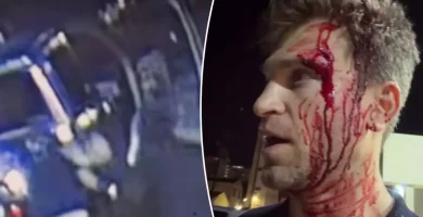 “Fairly Little Liars” star Keegan Allen was robbed at gunpoint and knife throughout an assault exterior a luxurious grocery retailer in Hollywood. 34 “Pretty Little Liars” star Keegan Allen was robbed at gunpoint and knife during an attack outside a luxury grocery store in Hollywood.